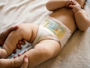 La irritación del pañal ¿Cómo tratarla?