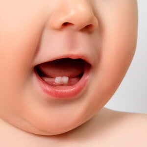 Consejos para cuando salen las molestias de los dientes