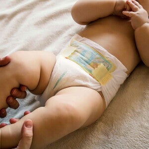 La irritación del pañal ¿Cómo tratarla?