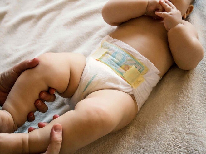 La irritación del pañal ¿Cómo tratarla?